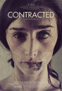 Contracted   ()