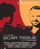 Scar Tissue / Jizva  (2017)