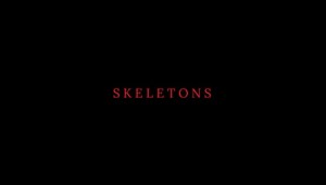 Skeletons - Trailer