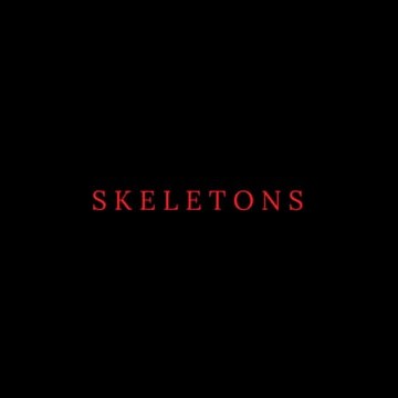 Skeletons - Trailer